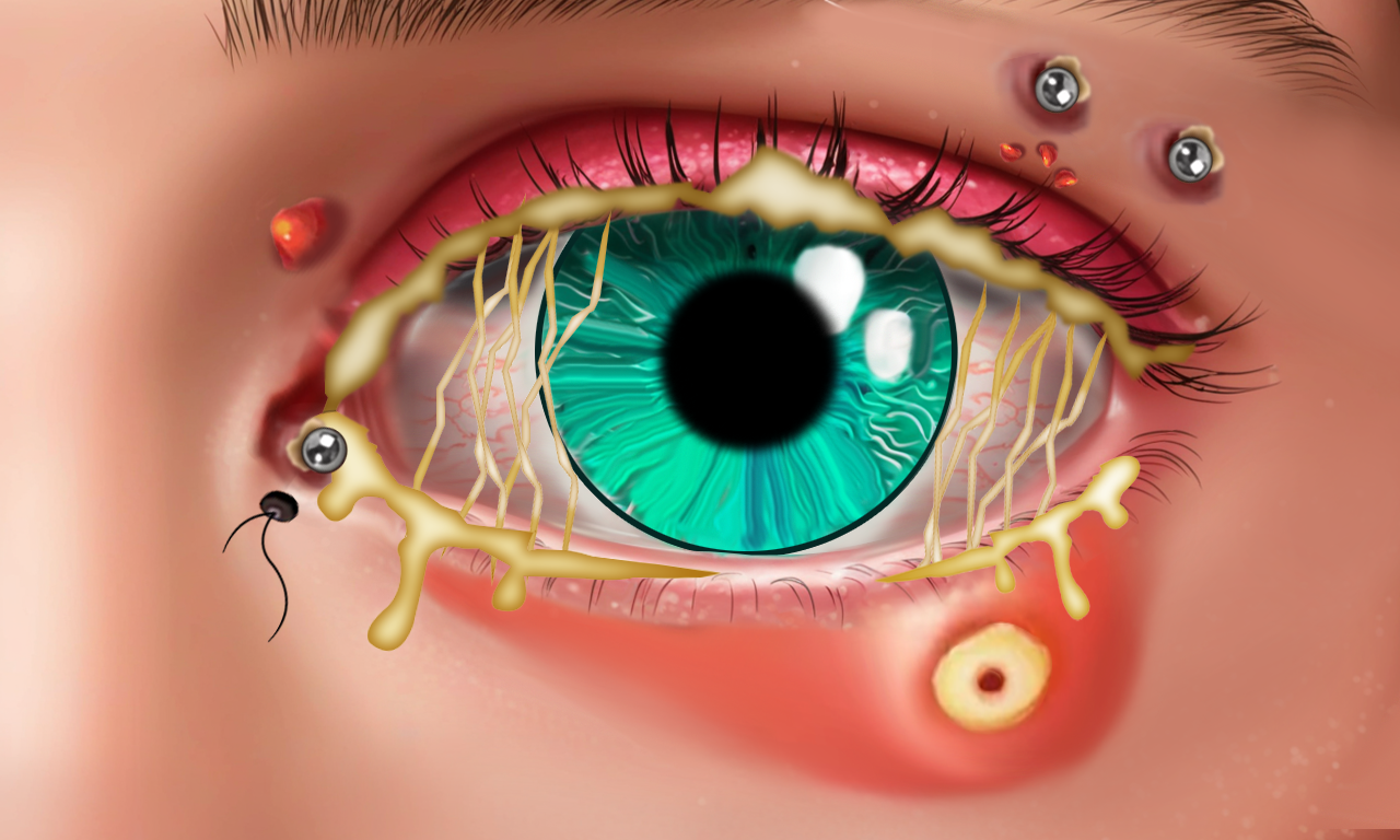 ASMR Eye Care — Gameplay Asset